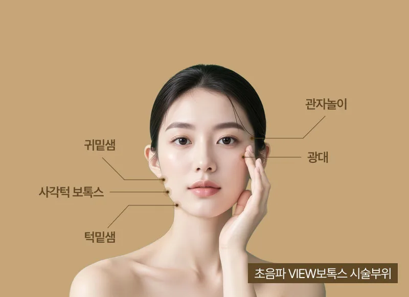 초음파 View톡스